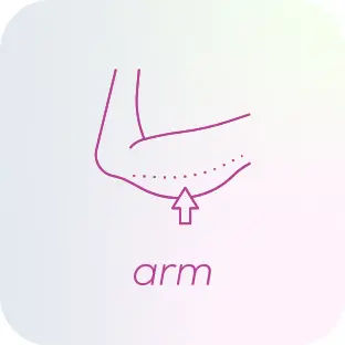 arm